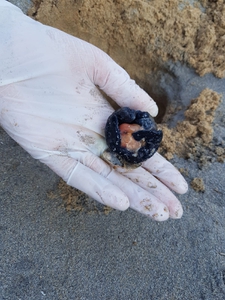 2019-08-25 Argostoli twin dead embyro 2019-08-25 Argostoli twin dead embyro