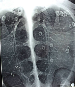 Circe Hooks X-Ray