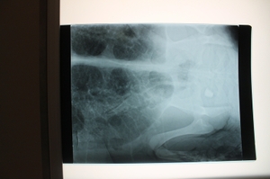 Male turtle with fishing line pelvis